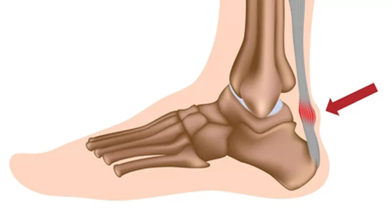 Orthopaedic doctor in Varthur