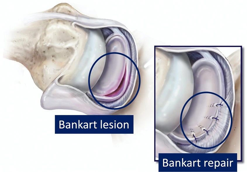  Ortho Specialist in Kundalahalli