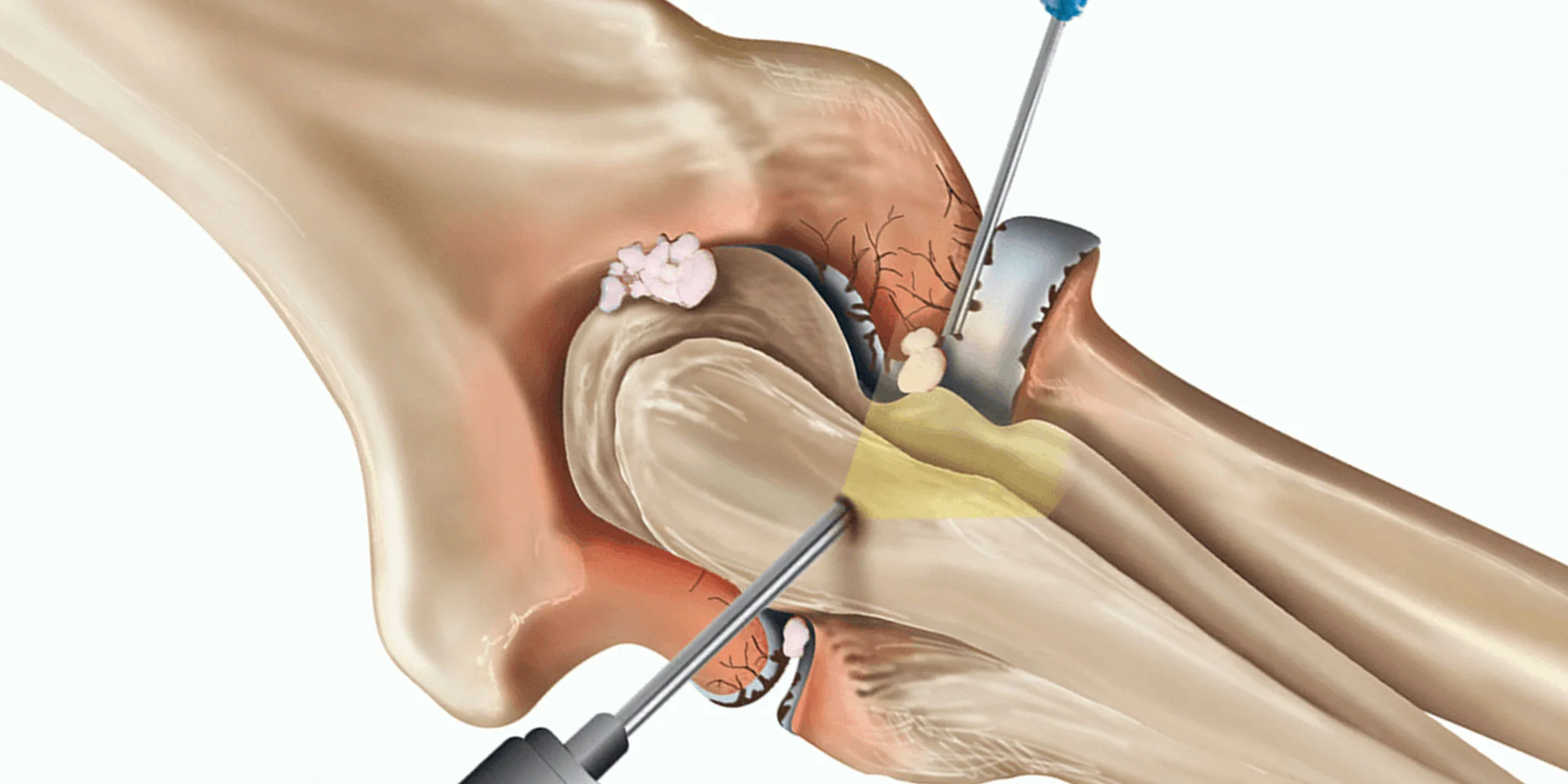 Ortho Expert in Kundalahalli