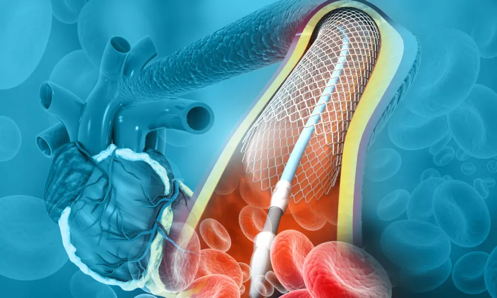  Ortho Specialist in Kundalahalli