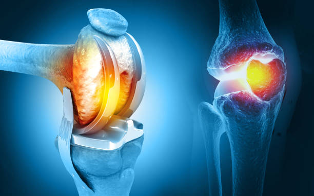 Joint Pain Treatment in Varthur