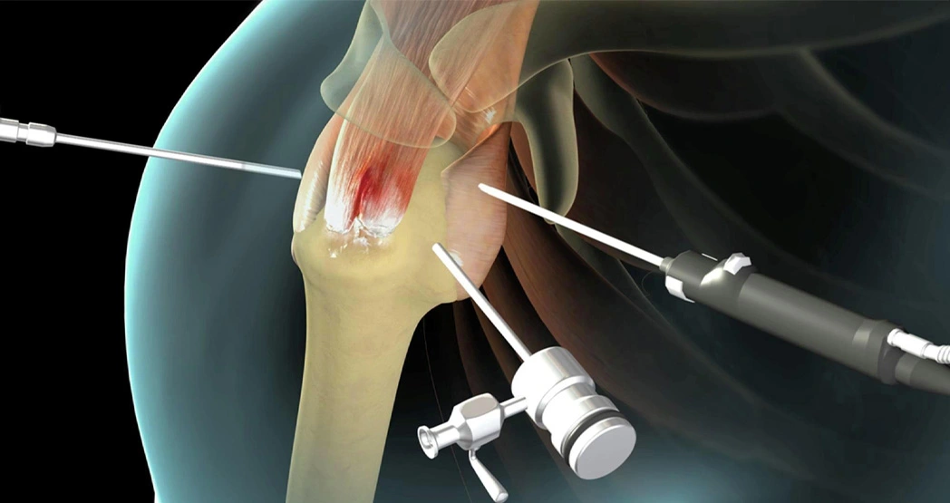  Ortho Specialist in Kundalahalli