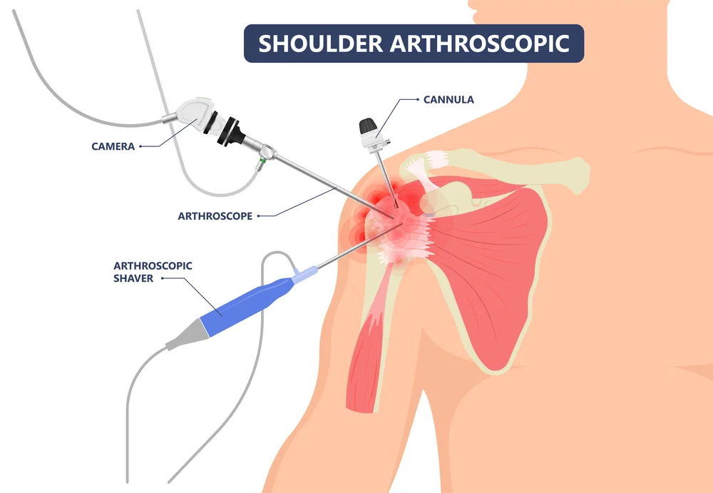  Ortho Specialist in Kundalahalli
