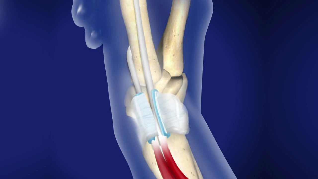 Trauma Care in Kundalahalli