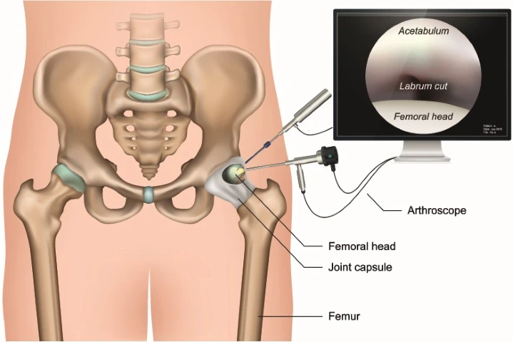  Hip Joint Pain in Kundalahalli
