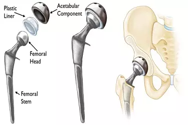 Ortho Surgeon in Varthur