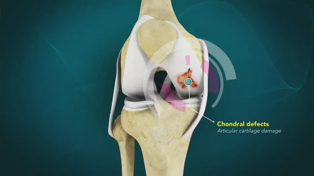 Minimally Invasive Surgery in Kundalahalli