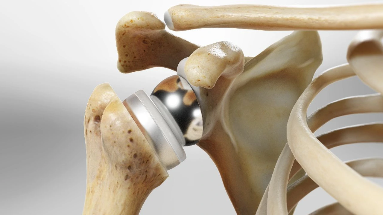  Shoulder Pain in Varthur
