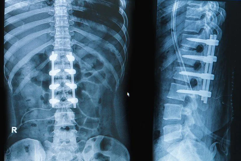 ElbowSpine Specialist
