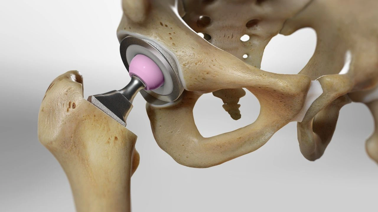 Ortho Surgeon in Varthur